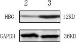 Rabbit IgG (H+L) Secondary Antibody in Western Blot (WB)