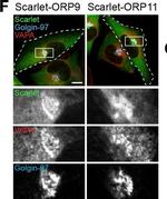 Mouse IgM (Heavy chain) Cross-Adsorbed Secondary Antibody in Immunocytochemistry (ICC/IF)