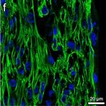Rabbit IgG (H+L) Cross-Adsorbed Secondary Antibody in Immunocytochemistry (ICC/IF)