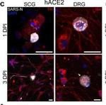 Mouse IgG (H+L) Cross-Adsorbed Secondary Antibody in Immunocytochemistry (ICC/IF)