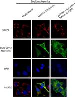 Rabbit IgG (H+L) Secondary Antibody in Immunocytochemistry (ICC/IF)