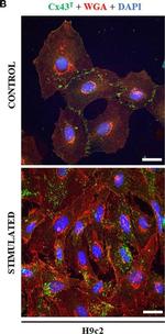 Rabbit IgG (H+L) Cross-Adsorbed Secondary Antibody in Immunocytochemistry (ICC/IF)