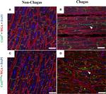 Rabbit IgG (H+L) Cross-Adsorbed Secondary Antibody in Immunohistochemistry (Paraffin) (IHC (P))