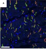 Rabbit IgG (H+L) Cross-Adsorbed Secondary Antibody in Immunohistochemistry (Paraffin) (IHC (P))