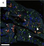 Rabbit IgG (H+L) Cross-Adsorbed Secondary Antibody in Immunohistochemistry (Paraffin) (IHC (P))
