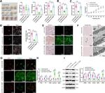 NOX1 Antibody in Western Blot (WB)