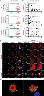Alpha-synuclein Antibody in Immunohistochemistry (Paraffin) (IHC (P))