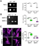 MMP2 Antibody in Immunocytochemistry (ICC/IF)