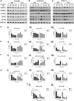PARP1 Antibody in Western Blot (WB)