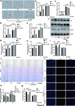 p21 Antibody in Western Blot (WB)