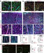 ALDH1L1 Antibody in Immunohistochemistry (Paraffin) (IHC (P))
