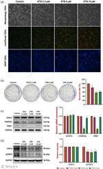 STAT3 Antibody in Western Blot (WB)