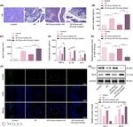 Arginase 1 Antibody in Western Blot (WB)