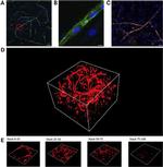 CD31 (PECAM-1) Antibody in Immunohistochemistry (IHC)