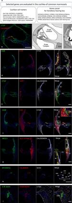 Connexin 26 Antibody in Immunohistochemistry (IHC)