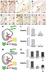 CD140a (PDGFRA) Antibody in Immunohistochemistry (IHC)