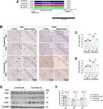 IBA1 Antibody in Immunohistochemistry (IHC)