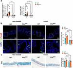 FOXP3 Antibody in Immunohistochemistry (Paraffin) (IHC (P))