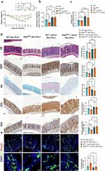 FOXP3 Antibody in Immunohistochemistry (Paraffin) (IHC (P))