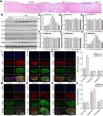 SIX3 Antibody in Western Blot (WB)