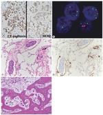 E-Cadherin Antibody in Immunohistochemistry (IHC)