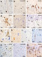 alpha Internexin Antibody in Immunohistochemistry (Paraffin) (IHC (P))