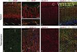 Claudin 3 Antibody in Immunohistochemistry (IHC)