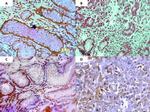 COX2 Antibody in Immunohistochemistry (Paraffin) (IHC (P))