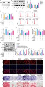 BTRC Antibody in Western Blot, Immunoprecipitation (WB, IP)