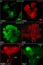PGP9.5 Antibody in Immunohistochemistry (IHC)