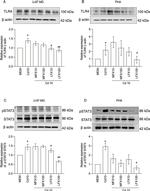 TLR4 Antibody in Western Blot (WB)