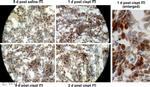 Granzyme B Antibody in Immunohistochemistry (IHC)