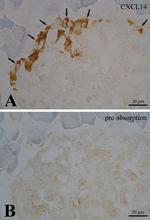 CXCL14 Antibody in Immunohistochemistry (IHC)