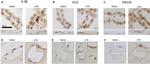 IL-1 beta Antibody in Immunohistochemistry (IHC)