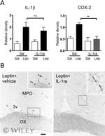 IL-1 beta Antibody in Immunohistochemistry (IHC)
