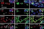 IL-1 beta Antibody in Immunohistochemistry (IHC)