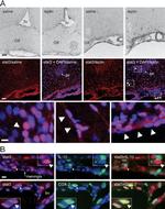 IL-1 beta Antibody in Immunohistochemistry (IHC)