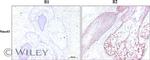 SMAD3 Antibody in Immunohistochemistry (IHC)