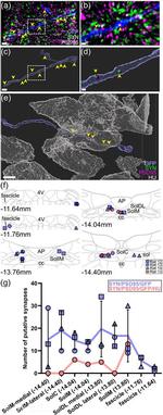 Synapsin 1 Antibody in Immunohistochemistry (IHC)