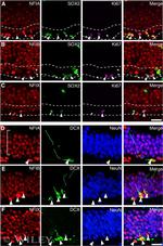 SOX2 Antibody in Immunohistochemistry (IHC)
