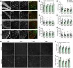 GFAP Antibody in Immunohistochemistry (PFA fixed) (IHC (PFA))