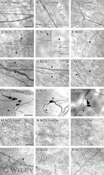 nNOS Antibody in Immunohistochemistry (Frozen) (IHC (F))