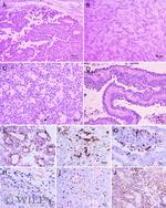 Connexin 26 Antibody in Immunohistochemistry (IHC)