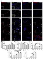 beta Catenin Antibody in Immunohistochemistry (Paraffin) (IHC (P))