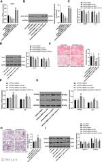 beta Catenin Antibody in Western Blot (WB)