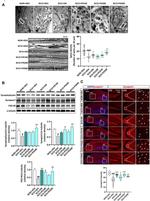 Synapsin 1 Antibody in Western Blot (WB)