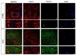 IL-8 (CXCL8) Antibody in Immunohistochemistry (PFA fixed) (IHC (PFA))
