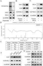 O-linked N-acetylglucosamine (O-GlcNAc) Antibody in Western Blot (WB)
