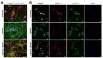 PAX6 Antibody in Immunocytochemistry (ICC/IF)