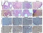 VEGF Antibody in Immunohistochemistry (Paraffin) (IHC (P))